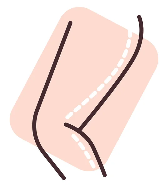 Chirurgie Amincissante Cuisse Illustration Vecteur Sur Fond Blanc — Image vectorielle