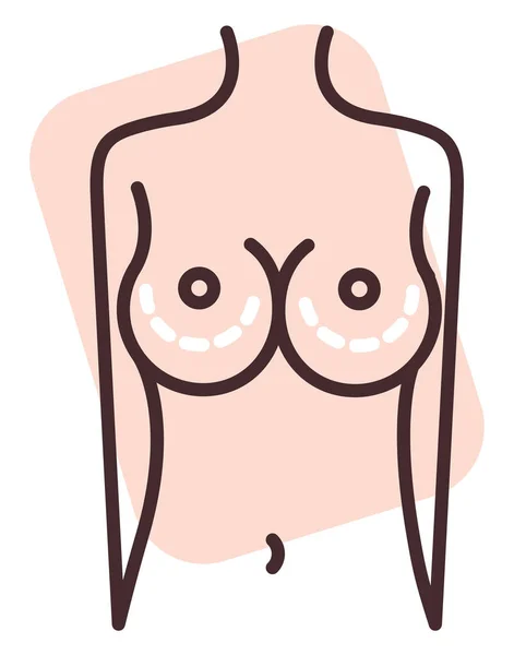 Cirurgia Mama Ilustração Vetor Sobre Fundo Branco —  Vetores de Stock