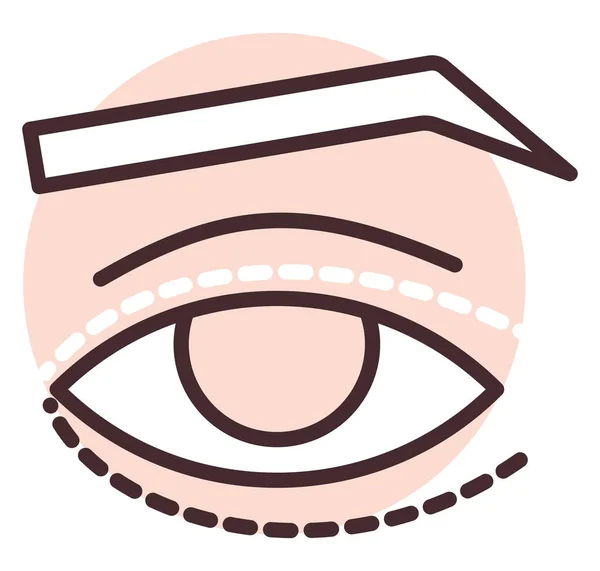 Augenlidchirurgie Illustration Vektor Auf Weißem Hintergrund — Stockvektor