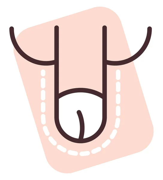 Penis Enlargement Surgery Illustration Vector White Background — Stock Vector