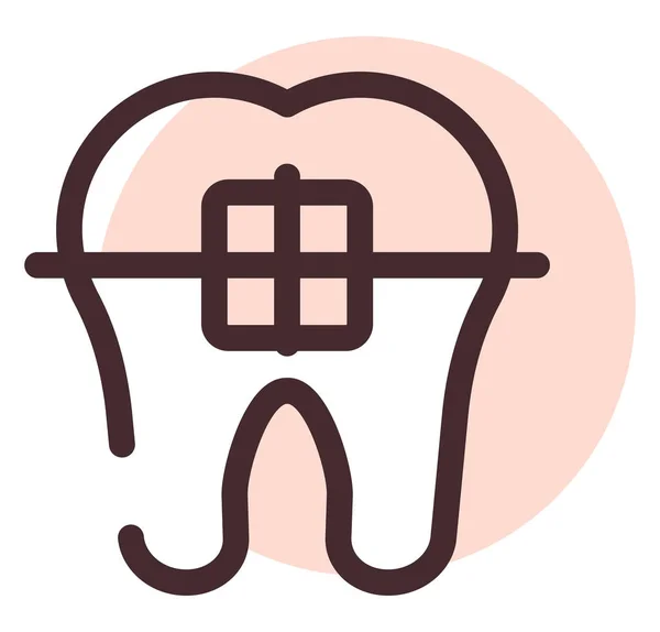 Bretelle Dentarie Illustrazione Vettore Sfondo Bianco — Vettoriale Stock