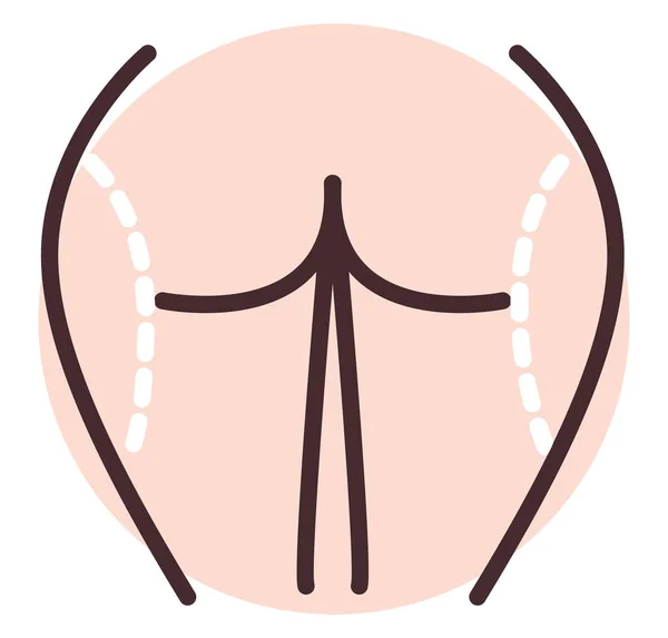 Hüftschlankheitschirurgie Illustration Vektor Auf Weißem Hintergrund — Stockvektor