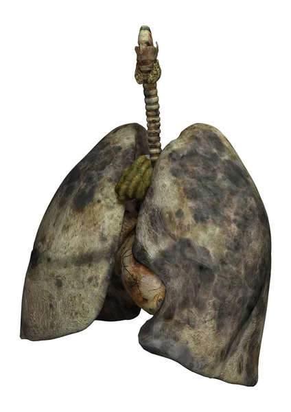 女性吸烟者的肺 — 图库照片