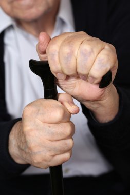 bir koltuk değneği üzerinde tutan kıdemli yetişkin adam