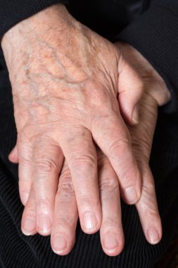 eski bir üst düzey çapraz eller