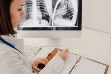 Hastanedeki genç kadın doktorun fotoğrafı. Bilgisayar ekranında göğüs röntgeni olan bir arkaplan