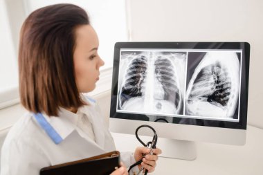 Hastanedeki genç kadın doktorun fotoğrafı. Bilgisayar ekranında göğüs röntgeni olan bir arkaplan