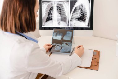 Genç kadın radyoloji doktoru röntgen ve bilgisayar tomografisi analizi ve not defterine tıbbi tanımlama.