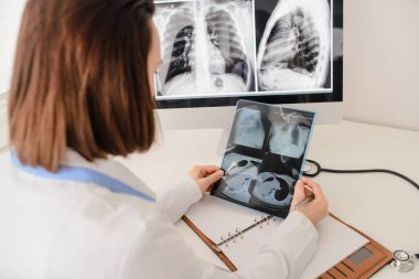 Genç kadın radyoloji doktoru röntgen ve bilgisayar tomografisi analizi ve not defterine tıbbi tanımlama.