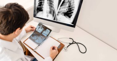 Genç adam radyolog röntgen ve bilgisayar tomografisi filmlerini analiz eder ve defterde tıbbi bir röntgen tanımlaması yapar. Metnin için boşluk kopyala