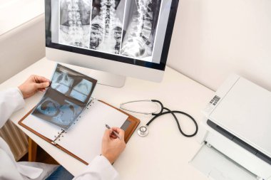 Genç adam radyoloji doktoru röntgen ve bilgisayar tomografisi filmini analiz etti ve defterde tıbbi bir açıklama yaptı.