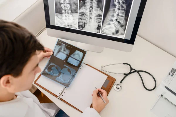 Vista Dall Alto Del Giovane Medico Radiologo Analizza Raggi Tomografia — Foto Stock