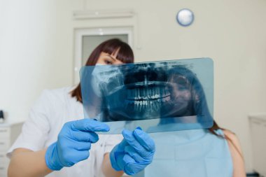 Genç kadın dişçi hastasına diş röntgeni panoramik radyografisinde diş hekimliğinde yapılması gereken tüm tedaviyi anlatıyor. Diş Xray dosyası tutuluyor