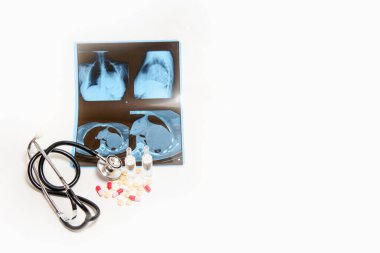 Coronavirus tedavisi konsepti. Şeffaf ampul, tüpler, göğüs röntgeninde steteskop yakınında koronavirüs zatürresi olan haplar. Metin için boşluk kopyala