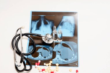 Coronavirus tedavisi konsepti. Göğüs röntgeni ve koronavirüs pnömonisi olan steteskop yakınındaki şeffaf ampul.