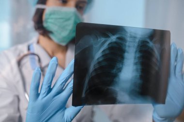Genç bayan doktor, klinikte göğüs röntgeni analizi yapıyor.