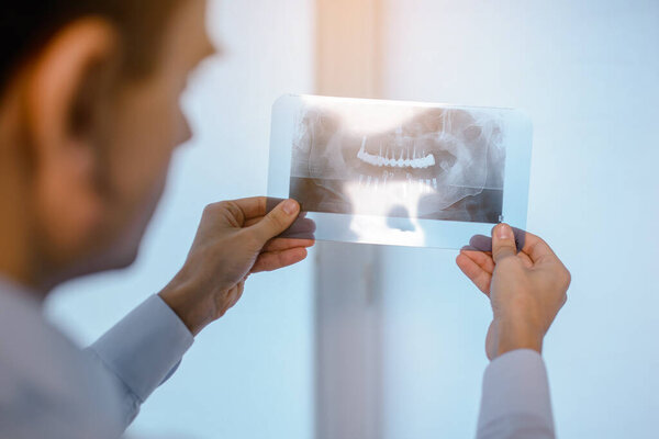 Close up picture of young man doctor dentist who analysis dental x ray orthopantomogram. Dental panoramic radiography