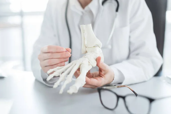 Dokter legt operatie uit aan voet op bot model — Stockfoto