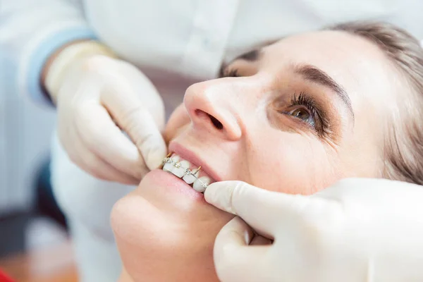 Tandläkare sätter tandställning på kvinnliga patienter tänder — Stockfoto
