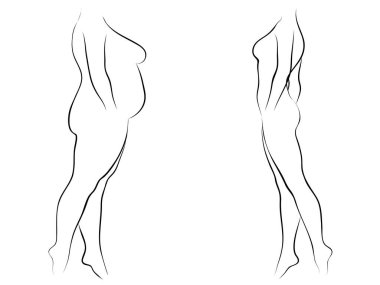 Vektör kavramsal şişman kilolu obez kadın vs fit sağlıklı vücut kilo kaybını takiben ince ya da diyet izole kas ince olan kadın. Fitness, beslenme veya şişmanlık obezite, sağlık siluet şekli