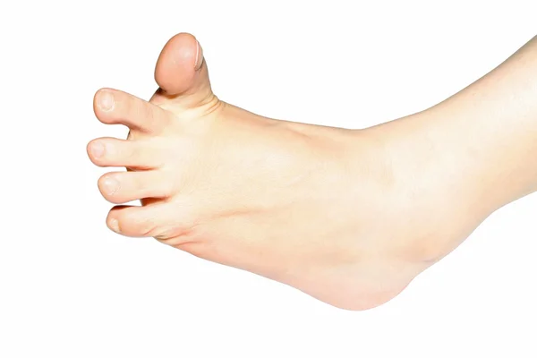 Young women's foot — Stock Photo, Image