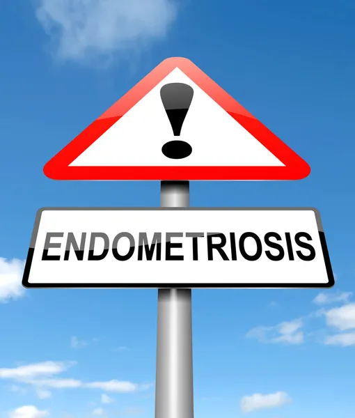Koncepcja endometriozy. — Zdjęcie stockowe