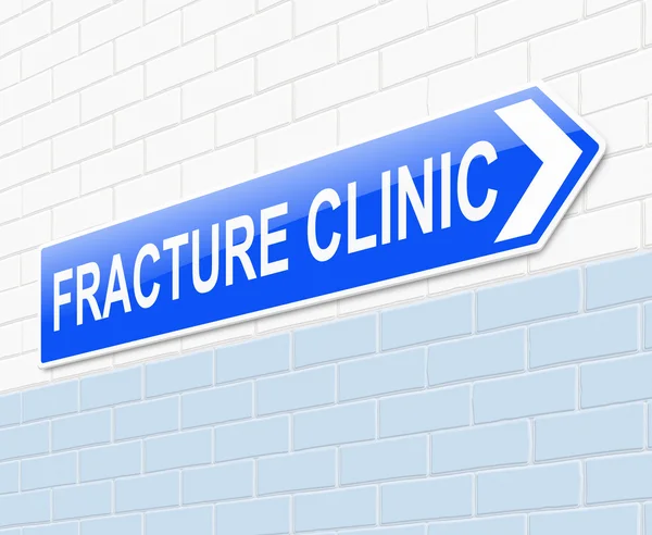 Fracture Clinic sign. — Stock Photo, Image