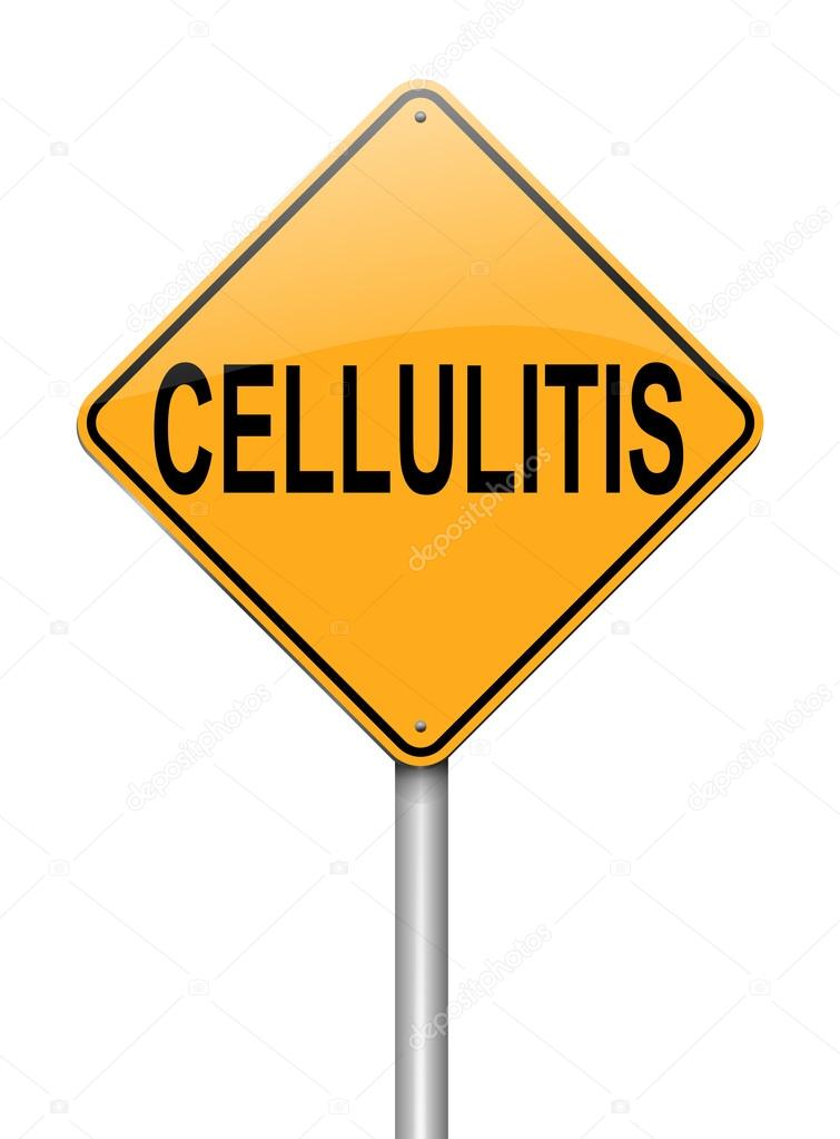 Cellulitis concept.