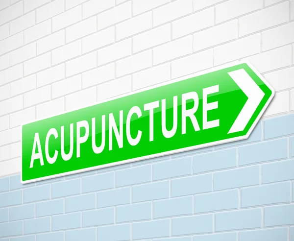 Concepto de acupuntura . —  Fotos de Stock