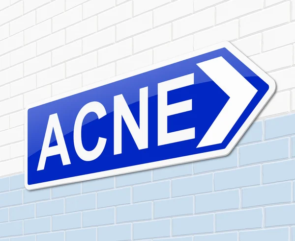 Acne concept. — Stock Photo, Image