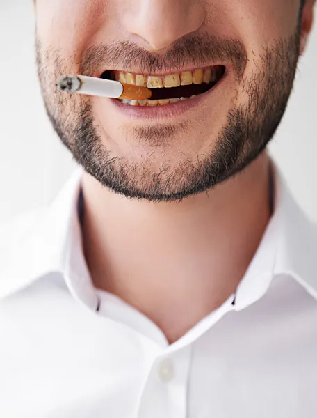 Smoking man with dirty yellow teeth — Stock Photo, Image