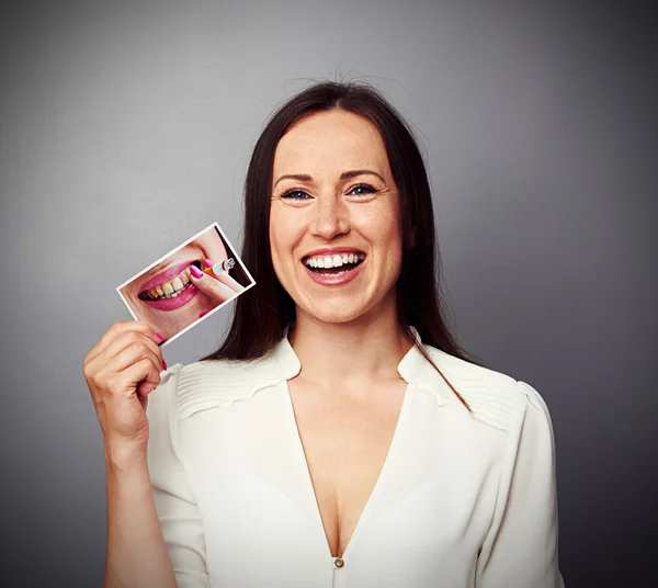 Woman holding picture with dirty yellow teeth — Stock Photo, Image