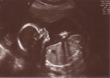 Scan Image of Unborn Child in Womb clipart