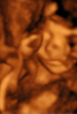 gebelik 3d tarama görüntü