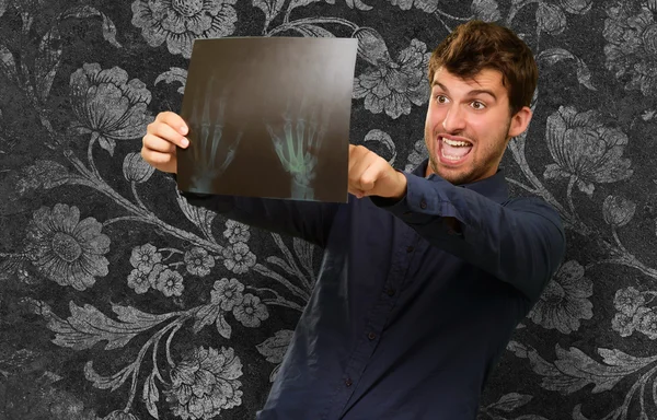 Jonge man houden x ray — Stockfoto