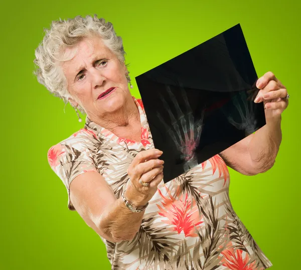 Senior Woman Holding X-ray — Stock Photo, Image