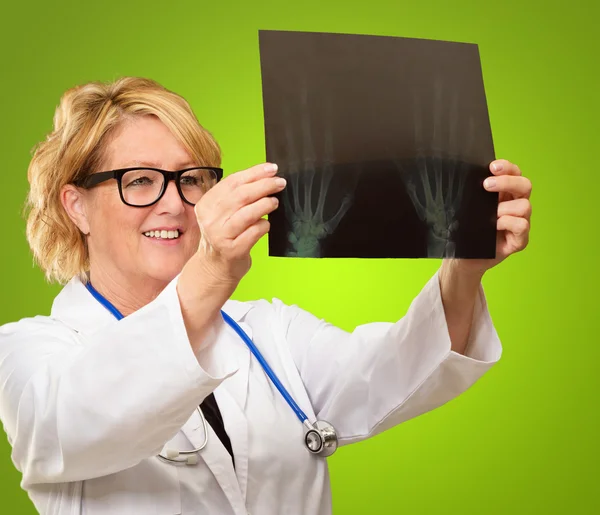 Kobieta lekarz badanie rentgenowskie raportu — Zdjęcie stockowe