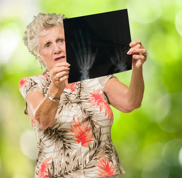 Triste mujer mayor mirando X Ray — Foto de Stock