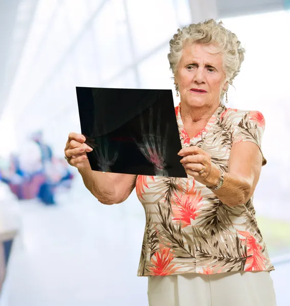 Traurige Seniorin blickt auf Röntgenbild — Stockfoto