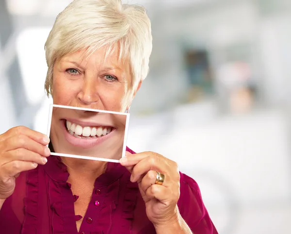 Starszy kobieta z manifying szkła Wyświetlono zębów — Zdjęcie stockowe