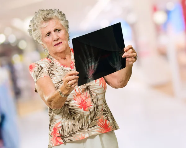 Mujer mayor sosteniendo informe de rayos X — Foto de Stock