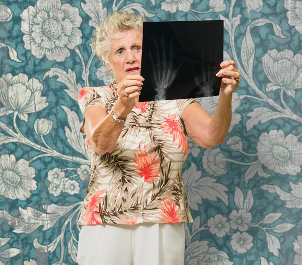 Senior Woman Holding X Ray Signaler — Photo