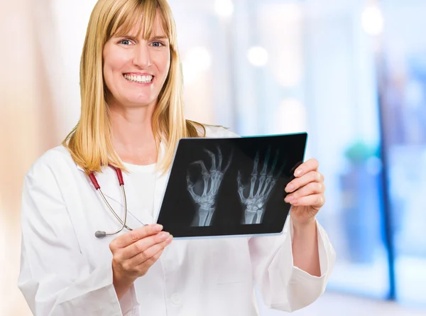 Retrato del doctor feliz sosteniendo rayos X — Foto de Stock