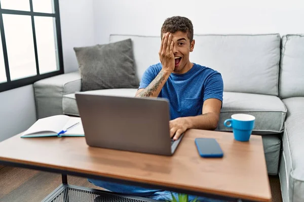 Jovem Homem Hispânico Bonito Usando Laptop Sentado Chão Cobrindo Olho — Fotografia de Stock