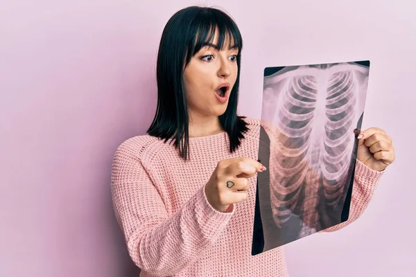 Mujer Hispana Joven Sosteniendo Radiografía Tórax Asustada Conmocionada Con Expresión —  Fotos de Stock