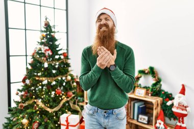 Kızıl saçlı, uzun sakallı, Noel ağacının yanında Noel şapkası takan elleri ve parmakları ağrıyan, eklem iltihabı olan bir adam. 