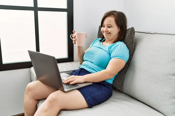 Mulher Morena Com Síndrome Sentado Sofá Usando Laptop Sala Estar — Fotografia de Stock
