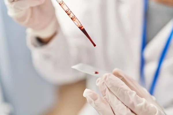 Young Blonde Woman Wearing Scientist Uniform Analysing Blood Laboratory — ストック写真
