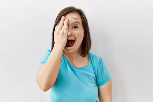 Mujer Síndrome Joven Pie Sobre Fondo Aislado Que Cubre Ojo — Foto de Stock