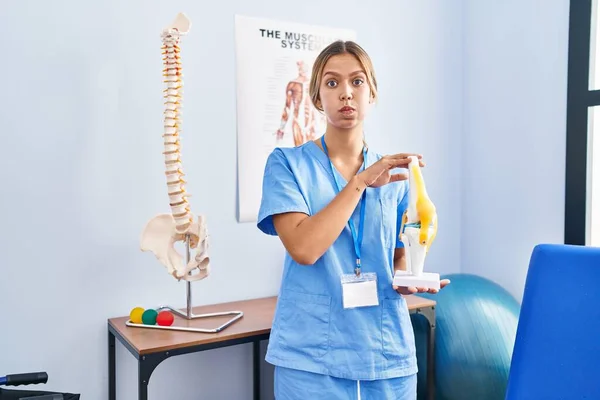 Jonge Blonde Orthopedische Vrouw Met Een Anatomisch Model Van Kniegewricht — Stockfoto